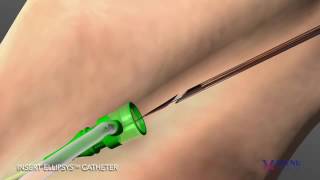 Avenu Medical Ellipsys Vascular Access System