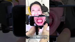 Teeth and smile photography with MK-017 and mobile phone - Dental photo and video fill light