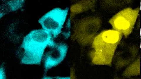 NIH3T3 cells expressing IRF-7-CFP and p65-YFP infected with Newcastle Disease Virus.