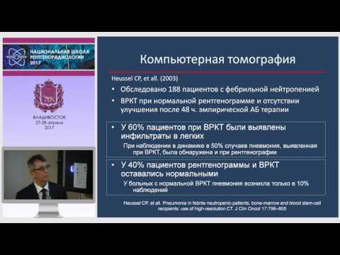 Видео: Влияние глюкокортикоидной терапии на смертность у пациентов с ревматоидным артритом и сопутствующим диабетом II типа: ретроспективное когортное исследование