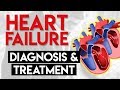 Diagnosis and Treatment | Heart Failure (Part 4)