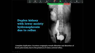 Q10  Revision Urinary module G  VI   Prof  Mamdouh Mahfouz HD
