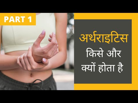 अर्थराइटिस (गठिया रोग) : जाने इसके प्रकार और लक्षण  [PART 1] (Explained in Hindi)