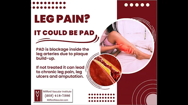 PAD Treatment New Haven CT - What is Peripheral Artery Disease (PAD)?