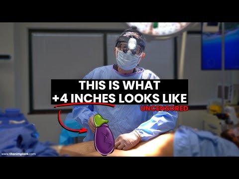 How To Low Testosterone Booster Part 18 Makerfuel Malehealth Facts Hightestosterone