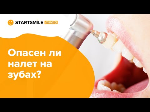 Налет на зубах | Причины и способы лечения