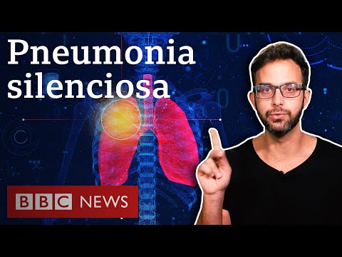 Vídeo: Coronavírus E Pneumonia: Sintomas De Pneumonia COVID-19, Tratamento