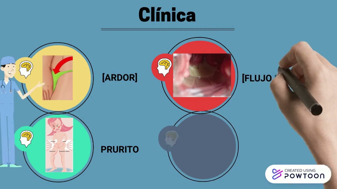 Cuanto tiempo dura una infeccion de orina