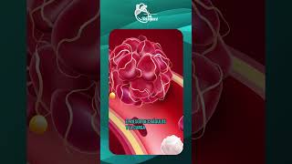 Sangre Espesa Cómo Afecta Tu Corazón?