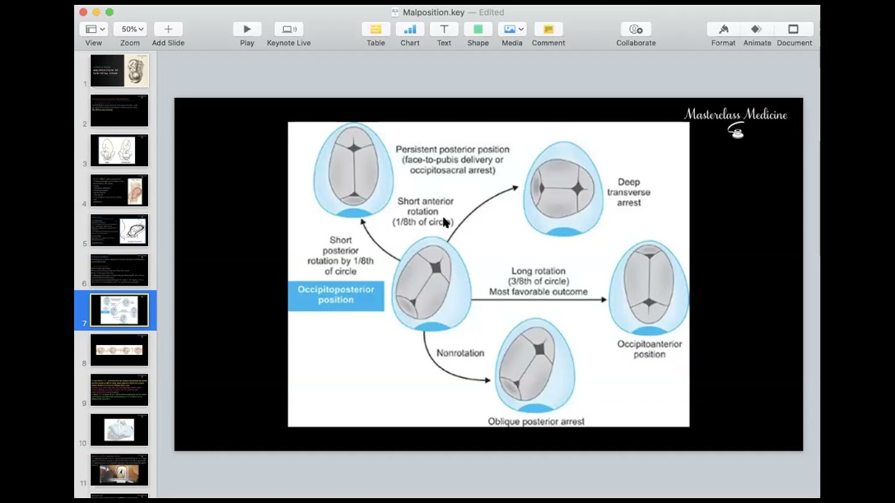 Malposition + Malpresentation 1 - OB course - Masterclass Medicine