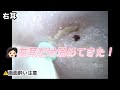 【2026.5.6】小学5年生の娘の耳👂耳介にも耳垢ありました!