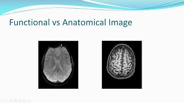 Why is Co-registration Segmentation and Regression Essential | SPM | MATLAB | Resting-state fMRI |