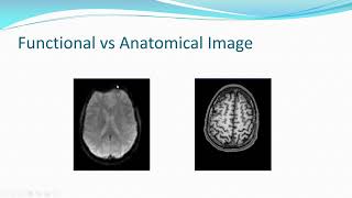 Why is Co-registration Segmentation and Regression Essential | SPM | MATLAB | Resting-state fMRI |