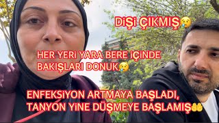 Her Yeri̇ Yara Bere İçi̇nde,Bakişlari Donukenfeksi̇yon Artmaya Başladi,Tansi̇yon Yi̇ne Düşmeye Başlamiş