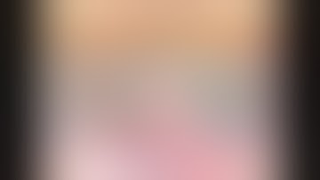 Rules of Divide & conquer phacoemulsification techniqueالخطوة الأساسية في عملية ازالة المياة البيضاء