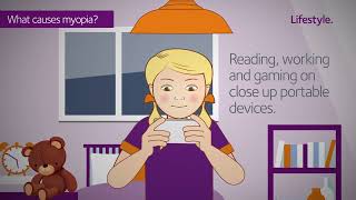 Misight Myopia Control Contact Lenses