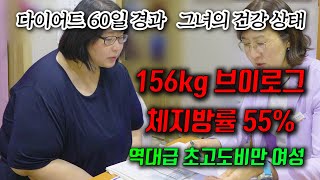 156kg 그녀 60일 경과 - 충격적인 건강 상태