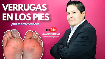 ¿Qué es el punto negro en una verruga plantar?