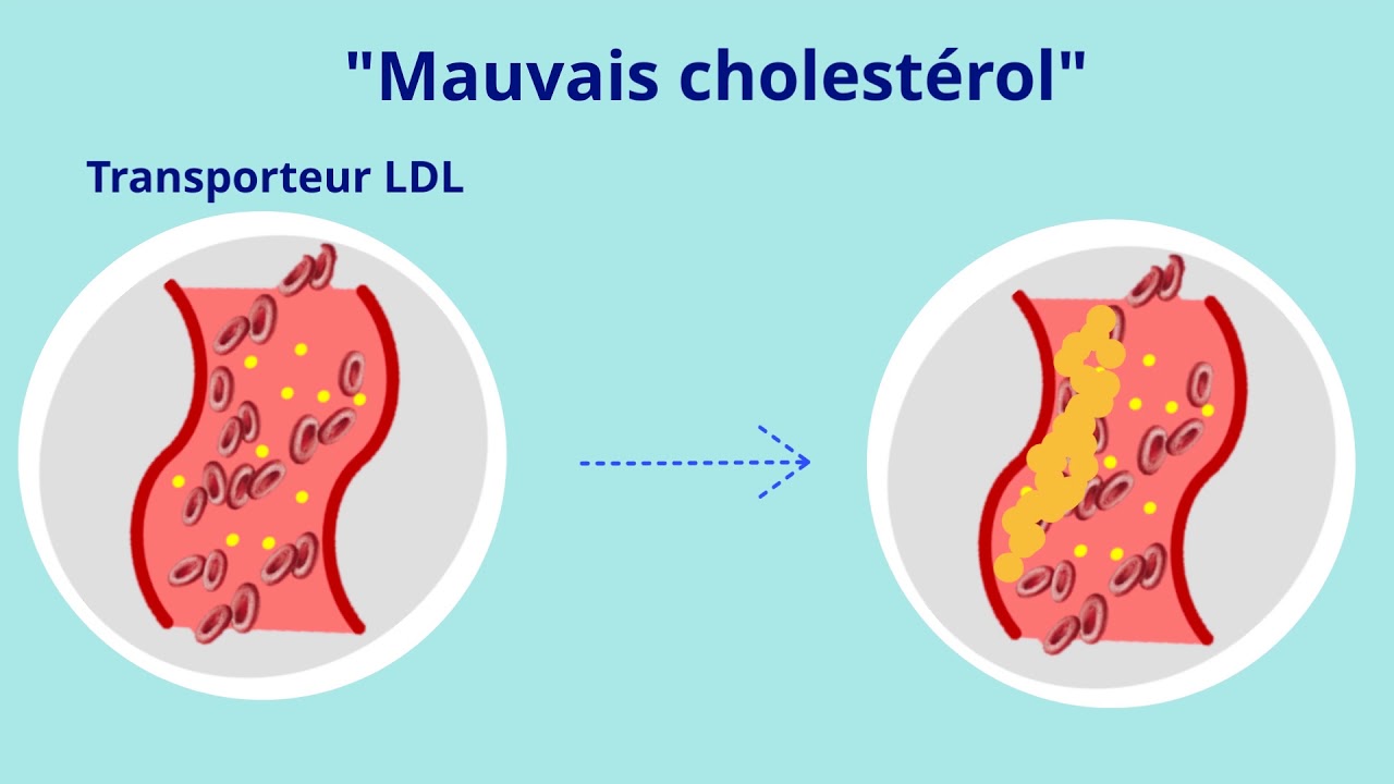 Autour du cœur Le Cholestérol YouTube