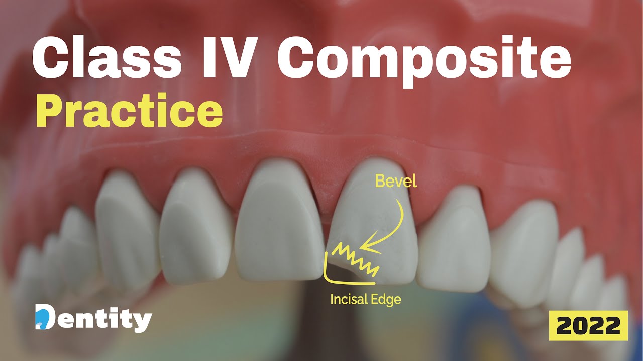 Class IV Composite Practice | حشوات الأسنان الأمامية عملي
