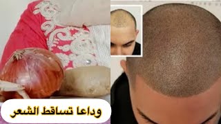 ينبت الشعر بغزارة كانك عامل زراعة شعر