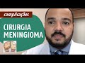 Principais Complicações | Cirurgia de Meningioma