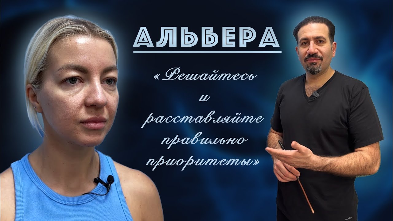Круговая блефаропластика: Албера из Китая - YouTube