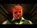 METAL GEAR SOLID V: THE PHANTOM PAIN - Trauma