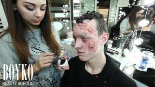 LESSON SPECIAL MAKE-UP. "CHEMICAL BURN"