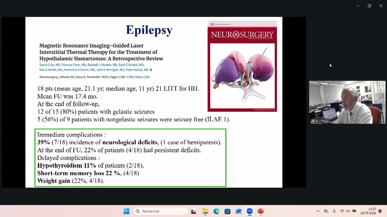 The role of Radiosurgery in Giant HH and after other failed treatments.