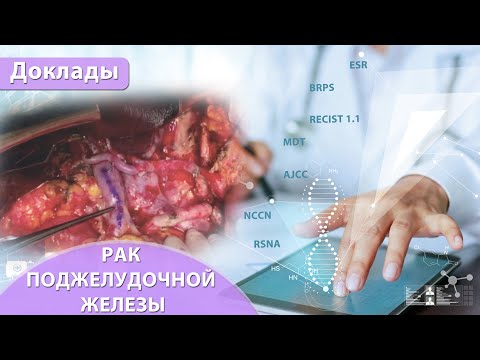 Рак поджелудочной железы радиолог/онколог. Екатерина Кульпина. Артем Зелинский