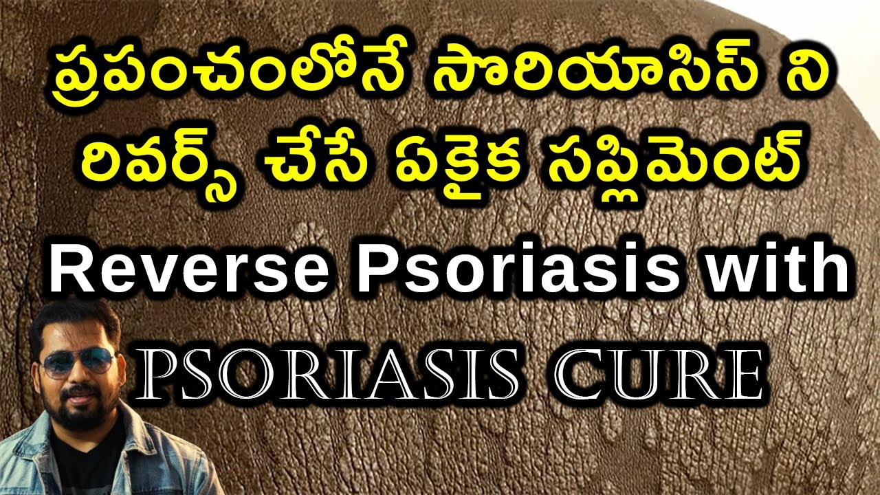 ప్రపంచంలోనే సొరియాసిస్ ని రివర్స్ చేసే ఏకైక సప్లిమెంట్ | Reverse Psoriasis  With This Supplement