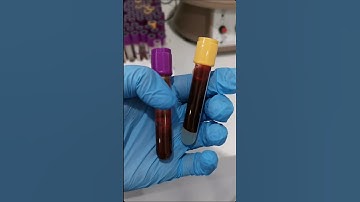 Medtech Life Laboratory Life #lablife #laboratory #mls #cls #medtechstudent #medtech #medtechlife