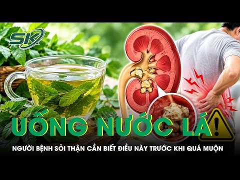 Believing the rumors about herbal water for kidney stones: what patients need to know before it's...