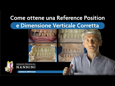 Video: Quali sono le dimensioni corrette di una croce?