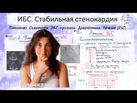 Самое важное по теме ИБС и стабильная стенокардия