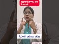 signs & symptoms of Anemia #anemia #diet #symptoms #viral #trending #ytshorts #shorts #video #iron