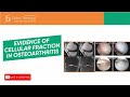 Evidence of Cellular fraction in OA
