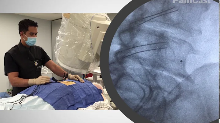 PREVIEW:  Dr  Kenneth B.  Chapman:  Radiofrequency...