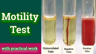 Motility test - Microbiology (Microbial Biochemical test) screenshot 2