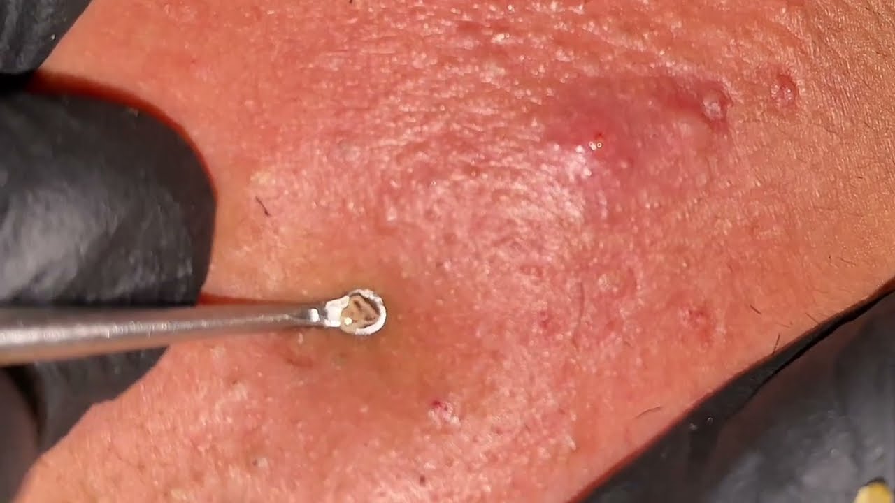 Skincare satisfying videos by Mahmoud Gamal #2007
