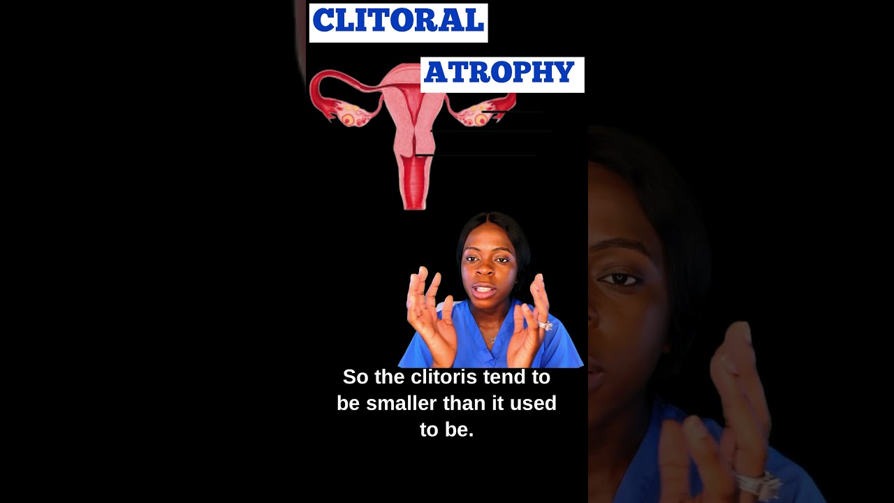 What is clitoral atrophy?