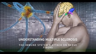 Understanding Multiple Sclerosis (MS): Causes, Symptoms, and Treatment | Immunology Demystified