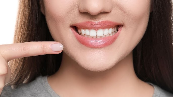 Discover the Power of Tooth Whitening - Is It Worth the Cost? - YouTube