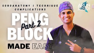 PENG BLOCK. PART 2. HIP ANALGESIA ANESTHESIA