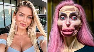 20 Celebrity Plastic Surgery Disasters (2026 Edition)