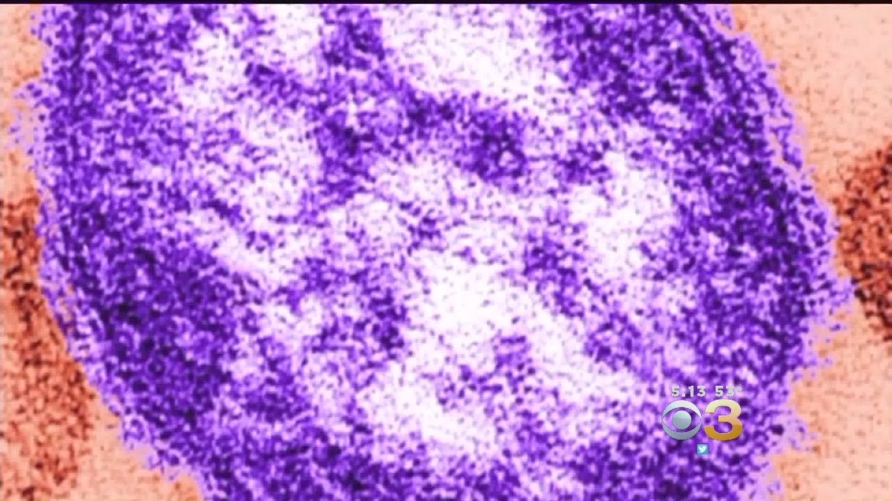 Health Officials Warn People May Have Been Exposed To Measles At Newark International Airport On Chr