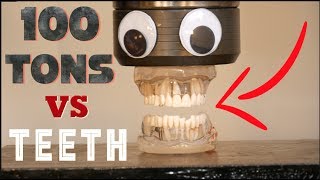 100 TONS vs TEETH! | Crushit