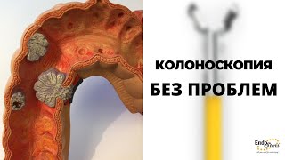 видео: Как делать колоноскопию. Многопрофильная клиника картинка: Как делать колоноскопию. Многопрофильная клиника