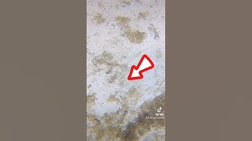 Egg under the microscope 🔬